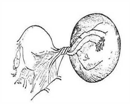 四川做试管可以生龙凤胎吗女孩几率大吗